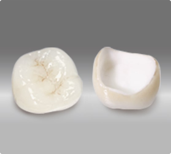 オールセラミック