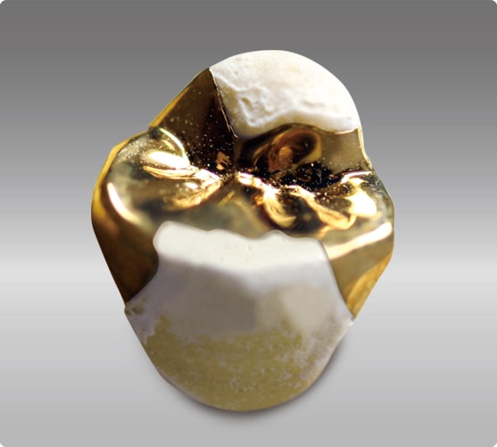 プラチナゴールド