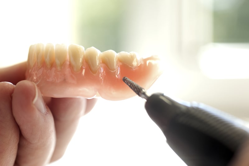 入れ歯のメンテナンス、修理