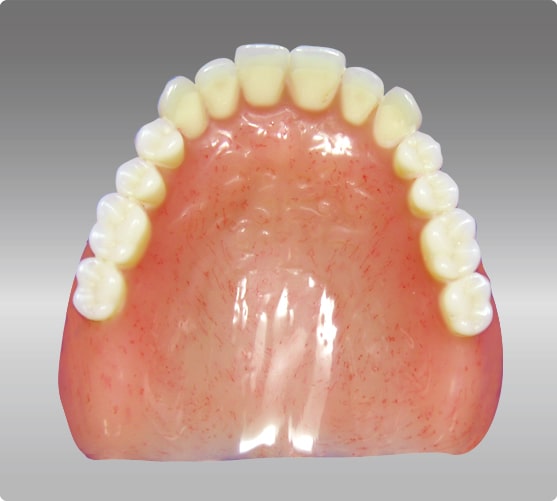 レジン床義歯
