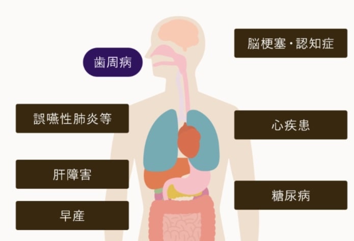 歯周病が与える全身へ影響
