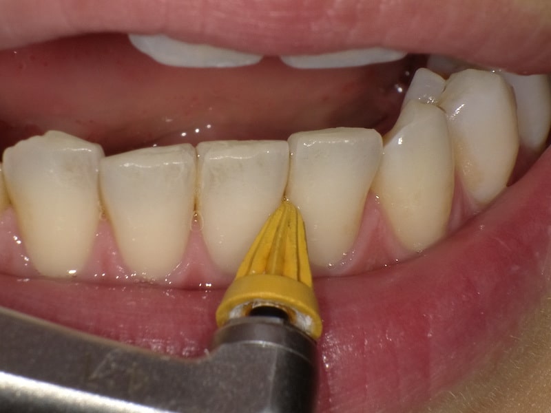 STEP3 清掃・研磨