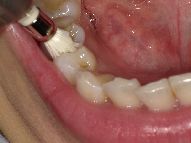 STEP3 清掃・研磨