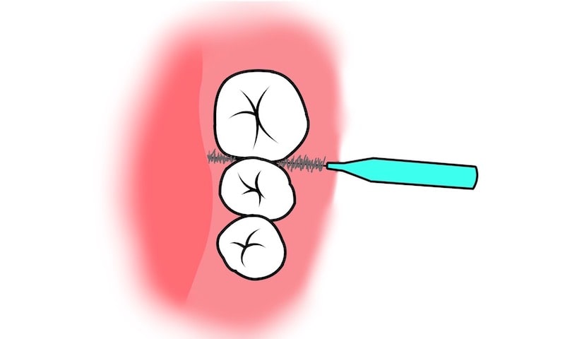 歯間ブラシの使い方